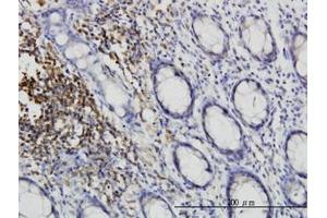 Image no. 2 for anti-C-Src tyrosine Kinase (CSK) (AA 1-101) antibody (ABIN598630) (CSK Antikörper  (AA 1-101))