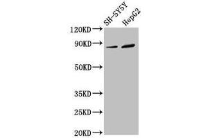 Western Blot Positive WB detected in: SH-SY5Y whole cell lysate, HepG2 whole cell lysate All lanes: DPY19L3 antibody at 3. (DPY19L3 Antikörper  (AA 587-697))
