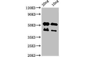 Western Blot Positive WB detected in Recombinant protein All lanes: lats2 antibody at 3 μg/mL Secondary Goat polyclonal to rabbit IgG at 1/50000 dilution Predicted band size: 43 kDa Observed band size: 43, 53 kDa (LATS2 Antikörper  (AA 1022-1140))