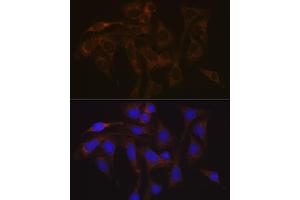 Immunofluorescence analysis of U-2 OS cells using V Rabbit mAb (ABIN7271312) at dilution of 1:100 (40x lens). (VAMP1 Antikörper)