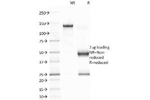 SDS-PAGE Analysis Purified EBV Mouse Monoclonal Antibody (CS1). (EBV LMP1 Antikörper)
