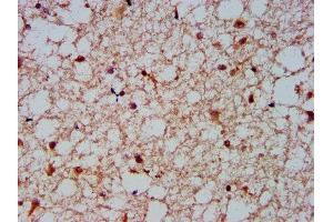 Immunohistochemistry (IHC) image for anti-Nuclear Factor of kappa Light Polypeptide Gene Enhancer in B-Cells Inhibitor-Like 1 (NFKBIL1) (AA 185-312) antibody (ABIN7161538)