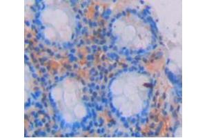 IHC-P analysis of Kidney tissue, with DAB staining. (GREM2 Antikörper  (AA 22-168))