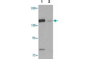Western blot analysis of N4BP1 in HeLa cell lysate with N4BP1 polyclonal antibody  at 0. (N4BP1 Antikörper  (N-Term))