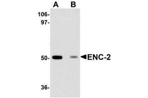 Western blot analysis of ENC-2 in Jurkat cell lysate with AP30315PU-N ENC-2 antibody at 1 μg/ml in (A) the absence and (B) the presence of blocking peptide. (KLHL25 Antikörper  (Center))