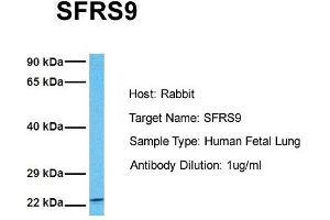 Western Blotting (WB) image for anti-serine/arginine-Rich Splicing Factor 9 (SFRS9) (Middle Region) antibody (ABIN2778869)