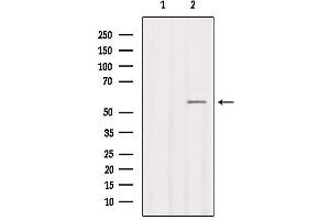 Western blot analysis of extracts from COS-7, using Cytochrome P450 2B6 Antibody. (CYP2B6 Antikörper)