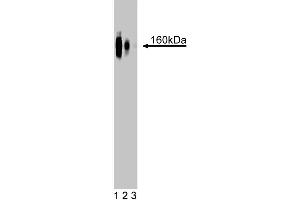 Western blot analysis of delta-Catenin on a rat cerebrum lysate. (CTNND2 Antikörper  (AA 85-194))