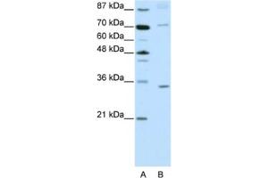 Western Blotting (WB) image for anti-Atonal Homolog 8 (ATOH8) antibody (ABIN2461959) (ATOH8 Antikörper)