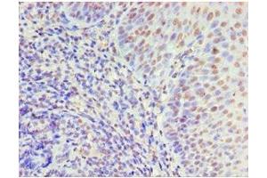 Immunohistochemistry of paraffin-embedded human tonsil tissue using ABIN7150338 at dilution of 1:100 (MCM5 Antikörper  (AA 1-230))