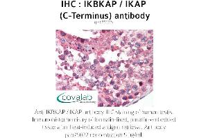 Image no. 1 for anti-Elongator Complex Protein 1 (ELP1) antibody (ABIN1735852) (IKAP/p150 Antikörper)