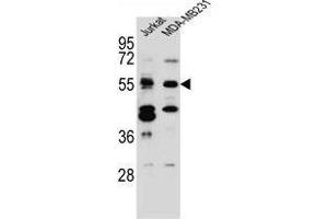 TNRC4 Antibody (N-term) western blot analysis in Jurkat,MDA-MB231 cell line lysates (35 µg/lane).