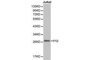 Western Blotting (WB) image for anti-Coagulation Factor XII (F12) antibody (ABIN1872625)
