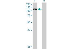 Western Blot analysis of CDH16 expression in transfected 293T cell line by CDH16 MaxPab polyclonal antibody. (Cadherin-16 Antikörper  (AA 1-829))