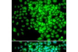 Immunofluorescence analysis of HeLa cells using POLR2F Polyclonal Antibody (POLR2F Antikörper)
