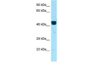 WB Suggested Anti-LIMS1 Antibody Titration: 1. (LIMS1 Antikörper  (Middle Region))