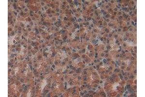 Immunohistochemistry (IHC) image for anti-Matrix Metallopeptidase 12 (Macrophage Elastase) (MMP12) (AA 20-99) antibody (ABIN7431755)