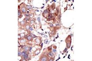 Image no. 2 for anti-Muscle, Skeletal, Receptor Tyrosine Kinase (MUSK) (C-Term) antibody (ABIN359903)