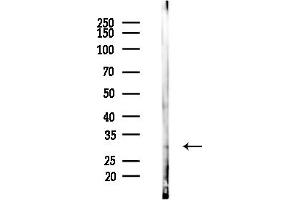 anti-Thymidine Kinase 1, Soluble (TK1) (pSer13) antibody