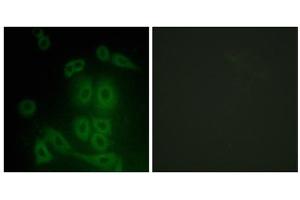Immunofluorescence analysis of A549 cells, using FXR2 antibody. (FXR2 Antikörper  (C-Term))