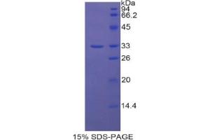 SDS-PAGE analysis of Human AST Protein. (Solute Carrier Family 17 (Acidic Sugar Transporter), Member 5 (SLC17A5) Protein)