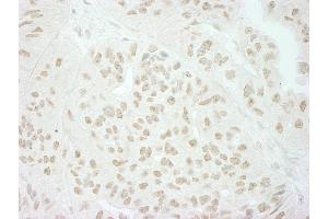 anti-Splicing Factor, Suppressor of White-Apricot Homolog (SFSWAP) (AA 500-550) antibody