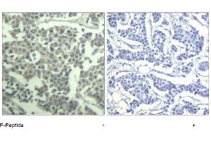 Image no. 1 for anti-Mast/stem Cell Growth Factor Receptor (KIT) (pTyr936) antibody (ABIN319288)