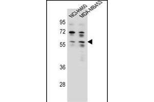 ANKRD34C Antibody (C-term) (ABIN655772 and ABIN2845210) western blot analysis in NCI-,MDA-M cell line lysates (35 μg/lane). (ANKRD34C Antikörper  (C-Term))