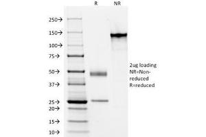 SDS-PAGE Analysis of Purified, BSA-Free Acidic Cytokeratin Antibody (clone AE1). (Keratin Acidic (AE1) Antikörper)