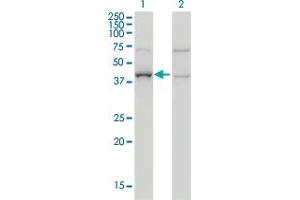 Western Blot analysis of ARMC8 expression in transfected 293T cell line by ARMC8 monoclonal antibody (M01), clone 2D9. (ARMC8 Antikörper  (AA 287-385))