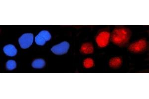 IF analysis of IFI16 using anti-IFI16 antibody (ABIN7600373).