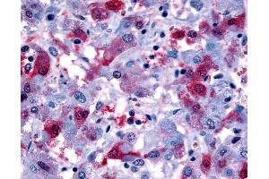 Immunohistochemistry (IHC) image for anti-Prostaglandin F Receptor (FP) (PTGFR) (Cytoplasmic Domain) antibody (ABIN1049265)