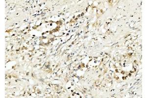 IHC analysis of PDCD4 using anti-PDCD4 antibody (ABIN5518943). (PDCD4 Antikörper  (AA 346-446))