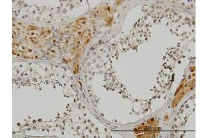 Image no. 1 for anti-CAMP Responsive Element Binding Protein 3 (CREB3) (AA 273-372) antibody (ABIN599141) (CREB3 Antikörper  (AA 273-372))
