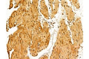 ABIN7094334 and ABIN7098381 at 1/100 staining Rat stomach tissue by IHC-P. (LARS2 Antikörper  (Internal Region))