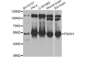 Western blot analysis of extracts of various cell lines, using FSCN1 antibody. (Fascin Antikörper)