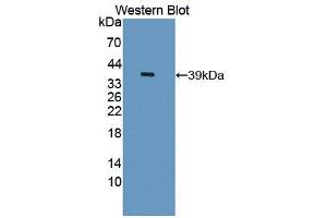 Western blot analysis of the recombinant protein. (PLSCR1 Antikörper  (AA 1-318))