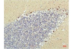 Immunohistochemical analysis of paraffin-embedded Human Brain Tissue using PPAR Delta Mouse mAb diluted at 1:200. (PPARD Antikörper)