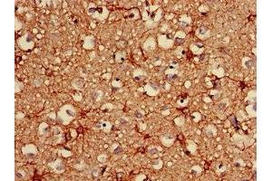 Immunohistochemistry of paraffin-embedded human brain tissue using ABIN7153847 at dilution of 1:100 (GFAP Antikörper  (AA 292-432))