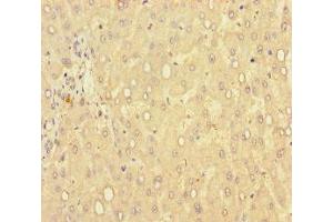 Immunohistochemistry of paraffin-embedded human liver tissue using ABIN7149462 at dilution of 1:100 (GLCE Antikörper  (AA 29-617))