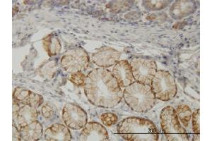 Immunoperoxidase of monoclonal antibody to TLN1 on formalin-fixed paraffin-embedded human small Intestine. (TLN1 Antikörper  (AA 1052-1149))