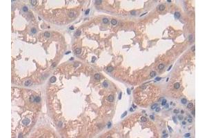 Detection of IL10 in Human Kidney Tissue using Polyclonal Antibody to Interleukin 10 (IL10) (IL-10 Antikörper  (AA 19-178))