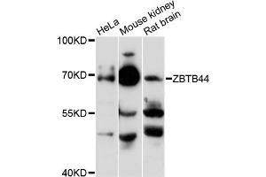 Western blot analysis of extracts of various cell lines, using ZBTB44 antibody (ABIN6291829) at 1:3000 dilution.