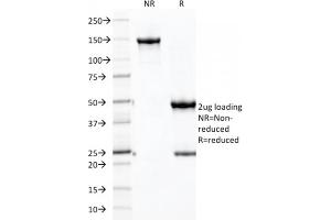 SDS-PAGE Analysis Purified CDH16 Mouse Monoclonal Antibody (CDH16/2125) (unconjugated). (Cadherin-16 Antikörper  (AA 371-507) (Biotin))
