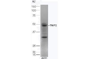Human A431 lysates probed with Rabbit Anti-TNIP2 Polyclonal Antibody, Unconjugated  at 1:5000 for 90 min at 37˚C. (TNIP2 Antikörper  (AA 85-180))