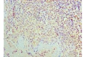 Immunohistochemistry of paraffin-embedded human tonsil tissue using ABIN7170857 at dilution of 1:100 (SMC1A Antikörper  (AA 1-130))