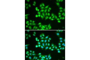 Immunofluorescence (IF) image for anti-Chromodomain Helicase DNA Binding Protein 2 (CHD2) antibody (ABIN1980262)