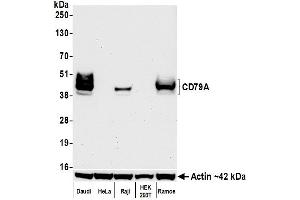 Western Blotting (WB) image for anti-B-cell antigen receptor complex-associated protein alpha chain (CD79A) (AA 176-226) antibody (ABIN7454005)