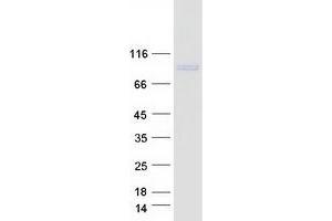 Western Blotting (WB) image for GIT1 (GIT1) (Transcript Variant 2) protein (Myc-DYKDDDDK Tag) (ABIN2721889)