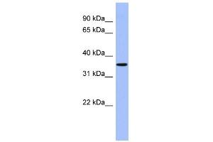 Western Blotting (WB) image for anti-Protein Phosphatase, Mg2+/Mn2+ Dependent, 1A (PPM1A) (Middle Region) antibody (ABIN2787379)